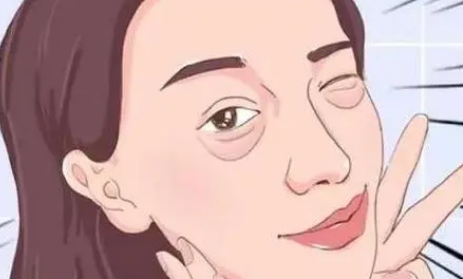 眼袋