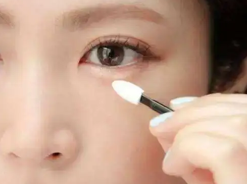 去眼袋手术