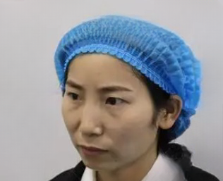 去眼袋手术
