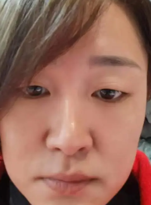 眼袋