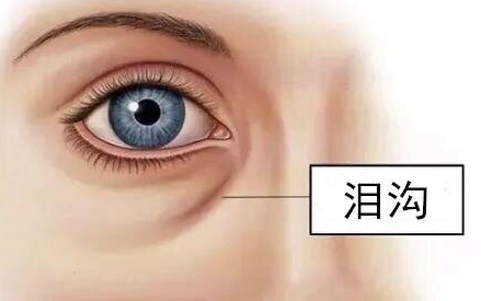 去眼袋手术