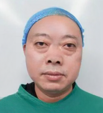 去眼袋手术