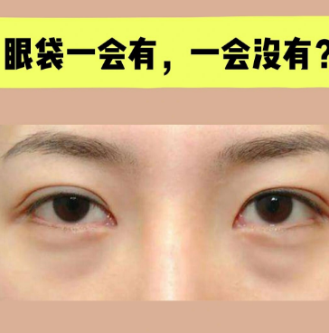 去眼袋手术