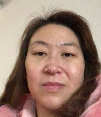 去眼袋手术