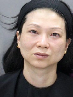 去眼袋手术
