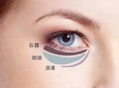 去眼袋手术