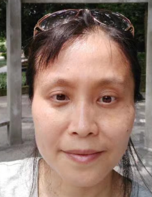 去眼袋手术