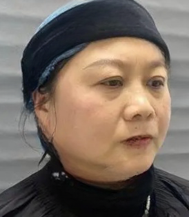 去眼袋手术