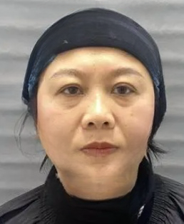 去眼袋手术