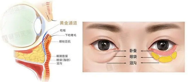 去眼袋手术