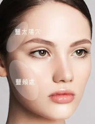 自体脂肪填充