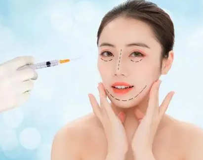 自体脂肪填充