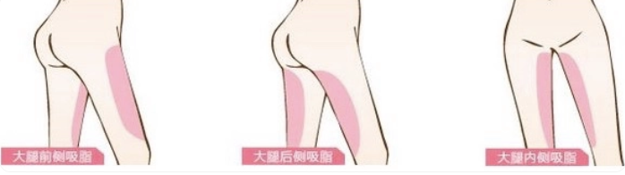 超声波减肥