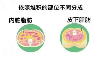 超声波减肥
