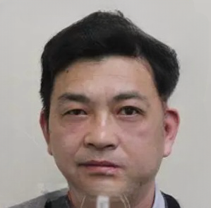 去眼袋手术
