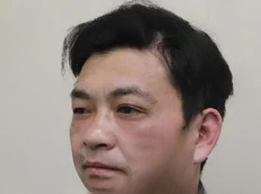 去眼袋手术