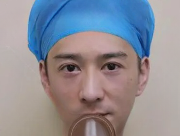 去眼袋手术