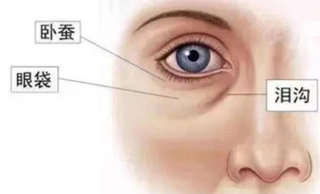 去眼袋手术