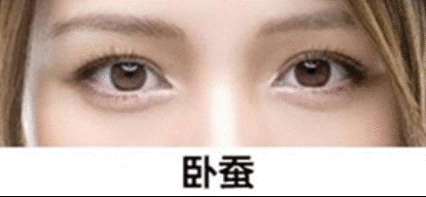 去眼袋手术