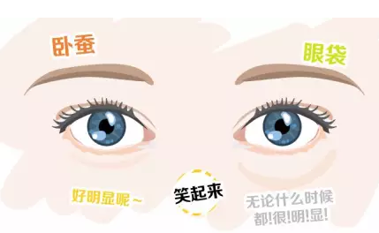 去眼袋手术