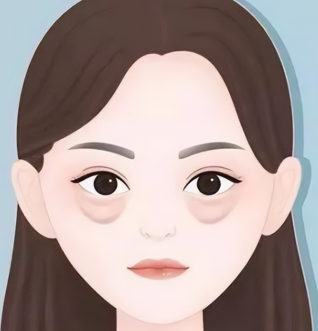 去眼袋手术