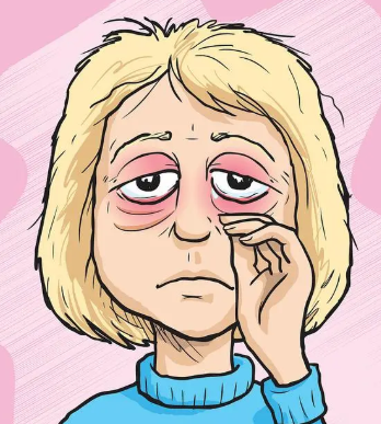 去眼袋手术