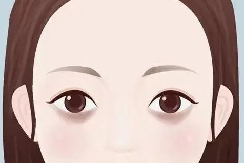 去眼袋手术