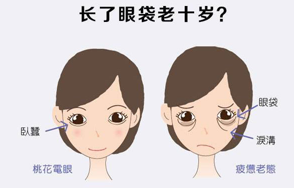 去眼袋手术