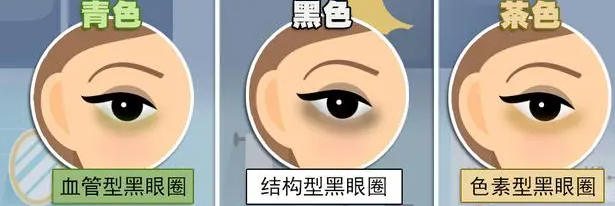 去眼袋手术
