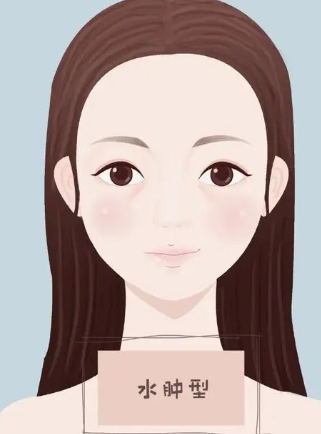 去眼袋手术