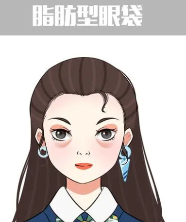 去眼袋手术