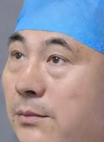 去眼袋手术