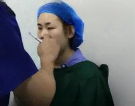 去眼袋手术
