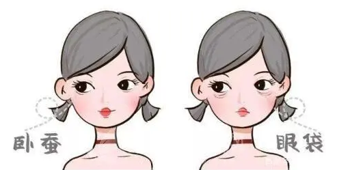 去眼袋手术