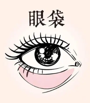 去眼袋手术