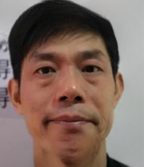 去眼袋手术