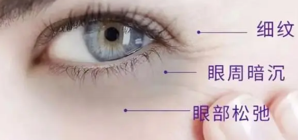 去眼袋手术