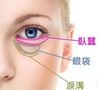 去眼袋手术