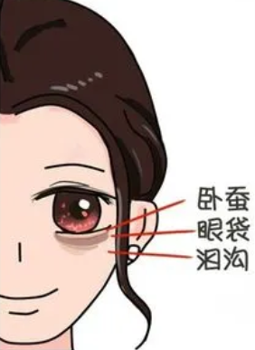 去眼袋手术