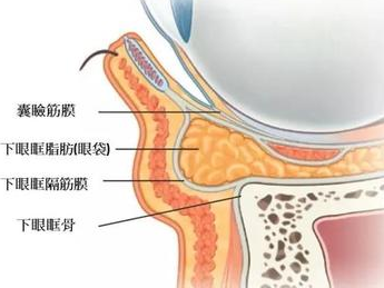 去眼袋手术