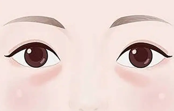 去眼袋手术