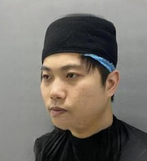 去眼袋手术