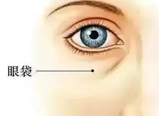 去眼袋手术