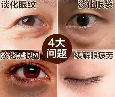 去眼袋手术