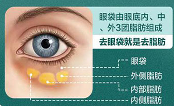 去眼袋手术