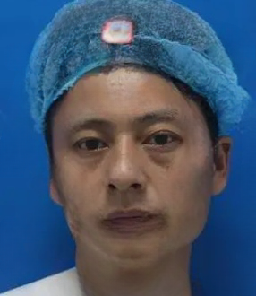 去眼袋手术