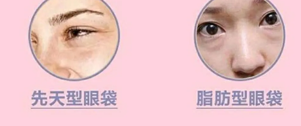 去眼袋手术
