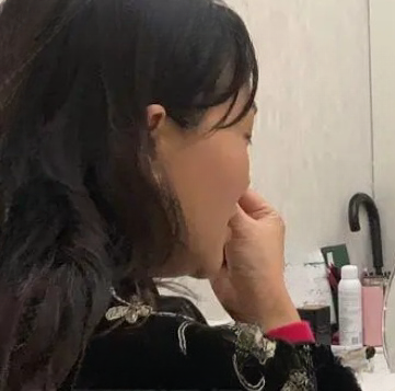 去眼袋手术