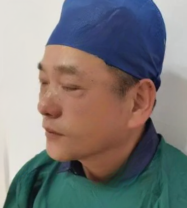 去眼袋手术