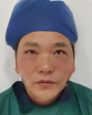 去眼袋手术